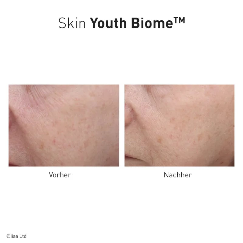ANP Skin Youth Biome 60 pièces complément alimentaire